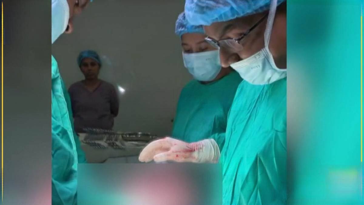 කාන්තාවකගේ ගර්භාෂයේ කිලෝ 10ක ගෙඩියක්